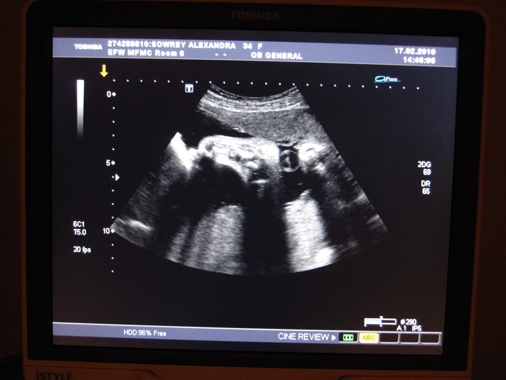 Choo Choo, 12 February 2010