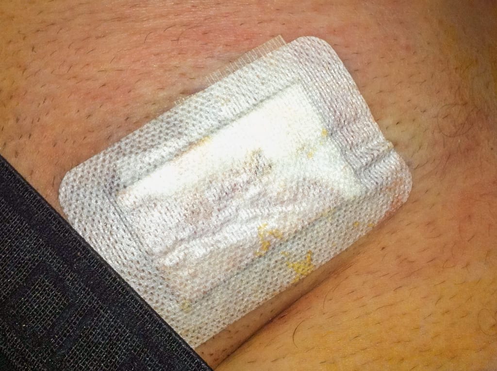 Surgery bandage, Westgate, Calgary, Alberta, 16 April 2011